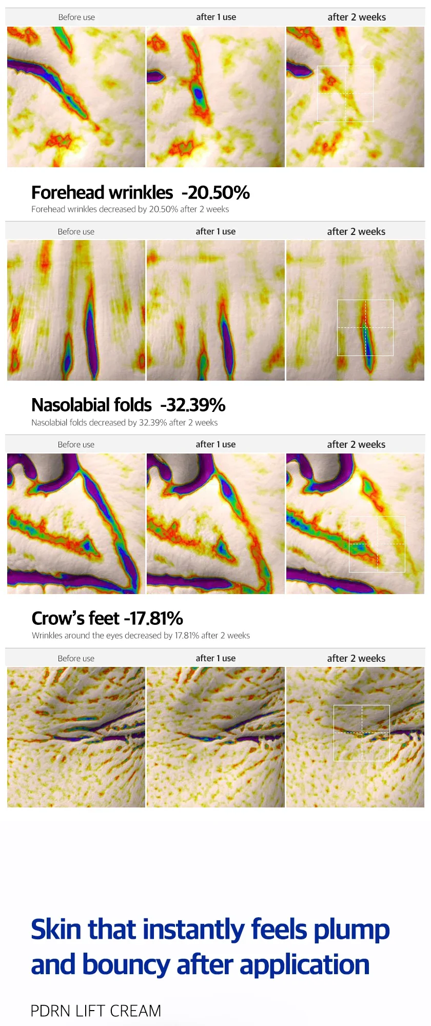 PDRN Lift Cream 상세 이미지 7