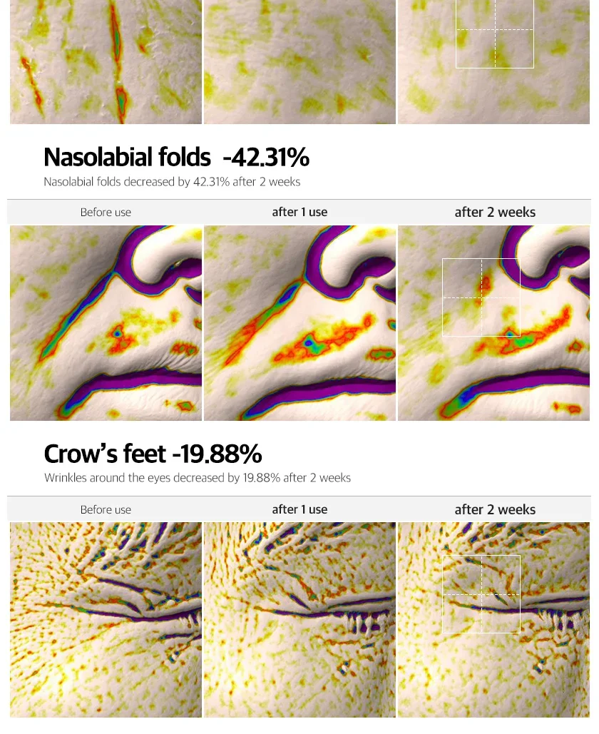PDRN Lift Fit Ampoule 상세 이미지 8