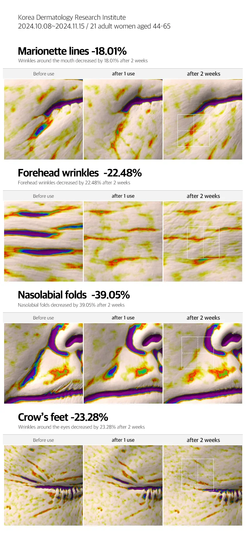PDRN Lift Facial Mask 상세 이미지 8