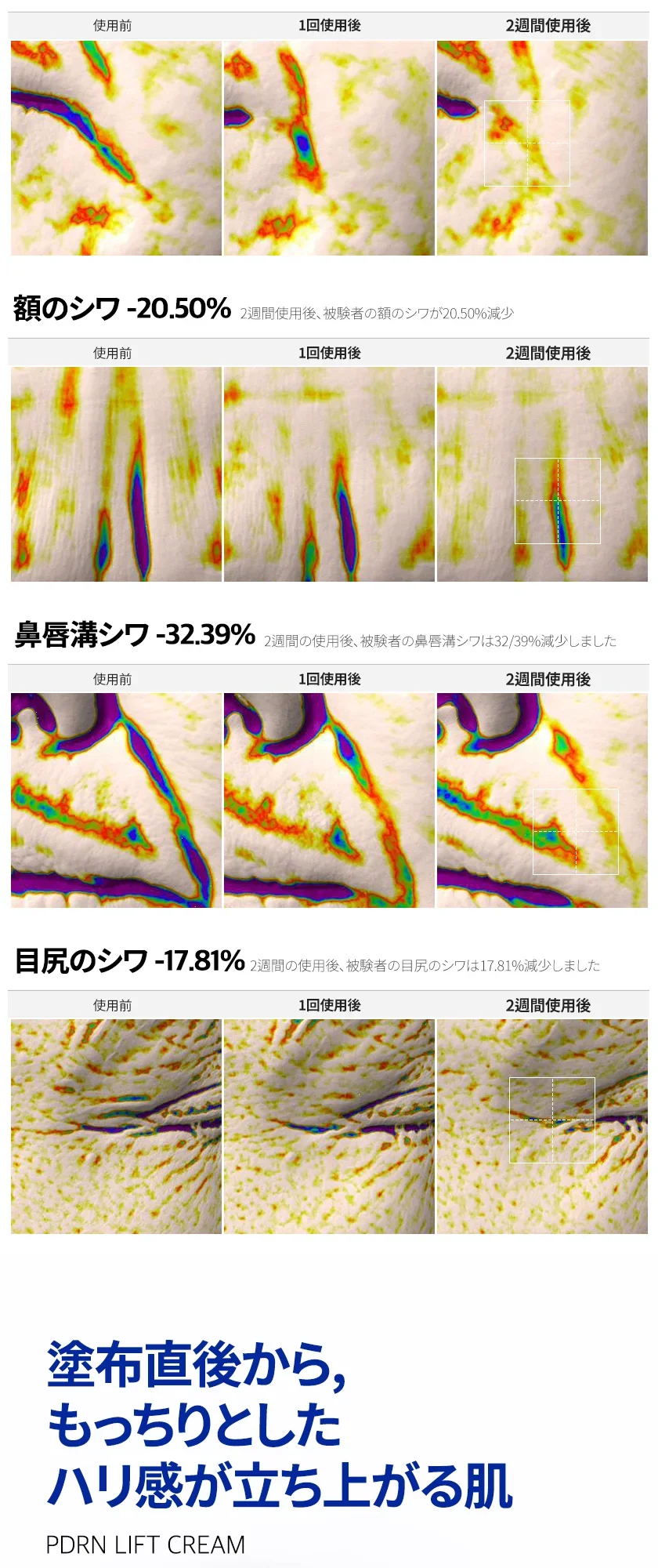 PDRN リフト クリーム 상세 이미지 7
