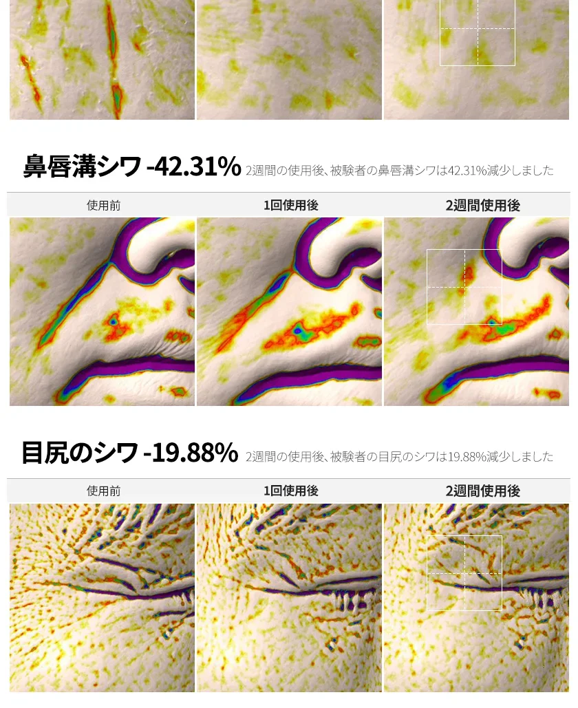 PDRN リフト フィット アンプル 상세 이미지 8