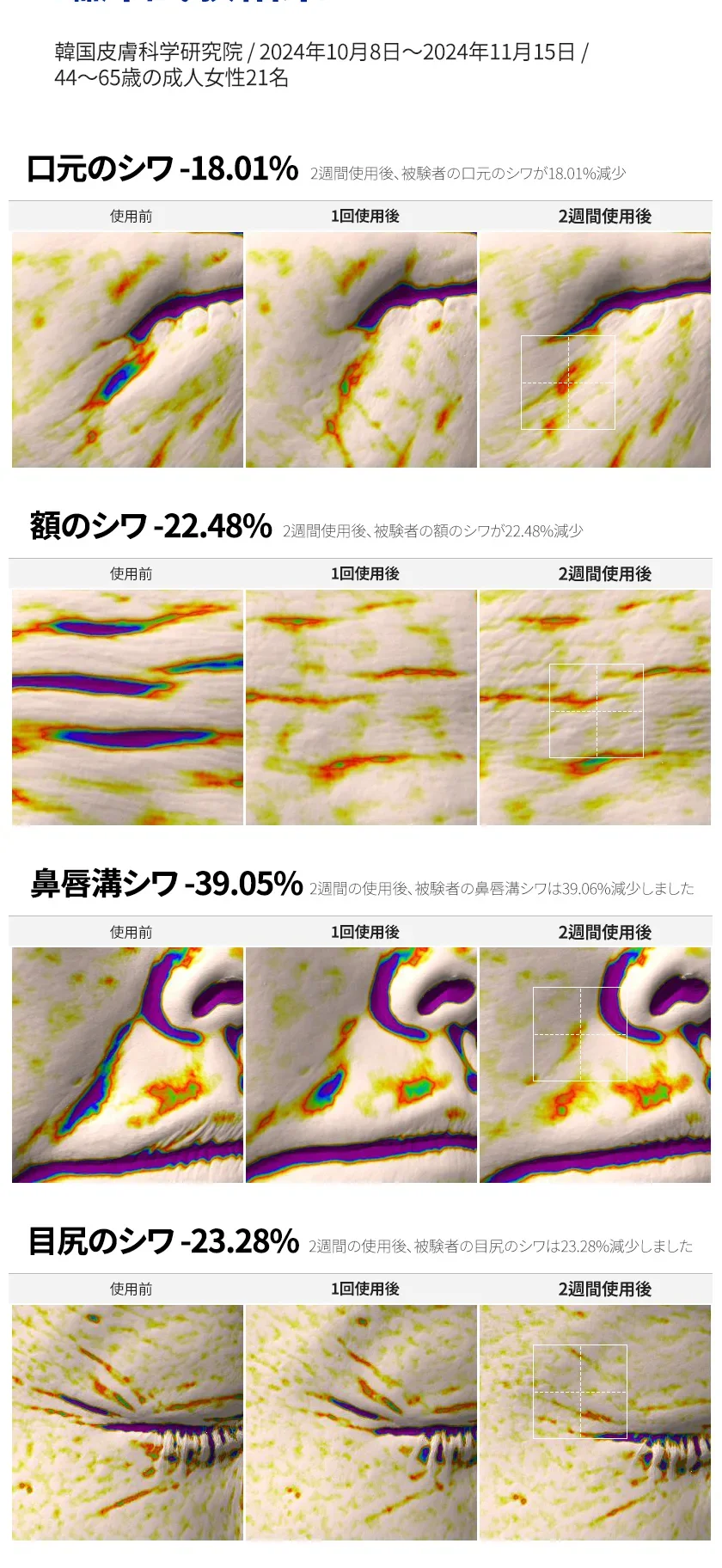 PDRN リフト フェイシャル マスク 상세 이미지 8